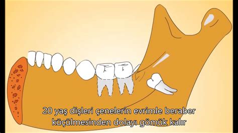 insan dişlerini neden sıkar